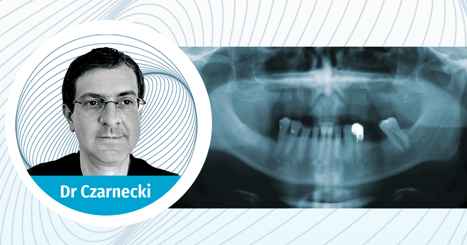 zoom-implantologie-czanrcki
