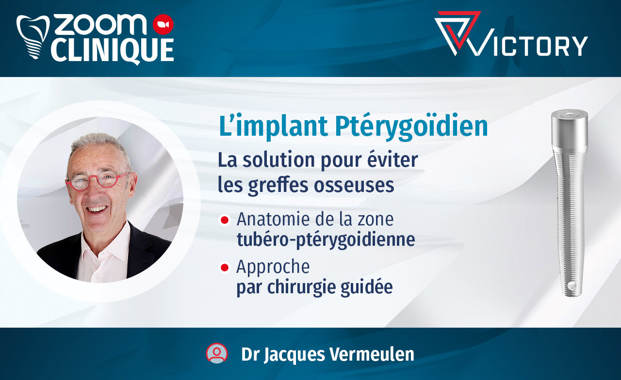 victory-implant-pterygoidien-dr-vermeulen