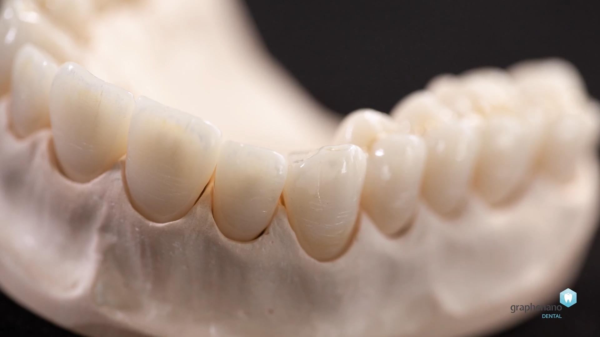 G-CAM - Pour prothèses définitives - Visy Implant Specialist